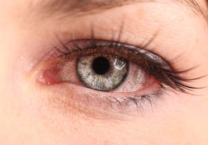 how to tell if you have pink eye or allergies