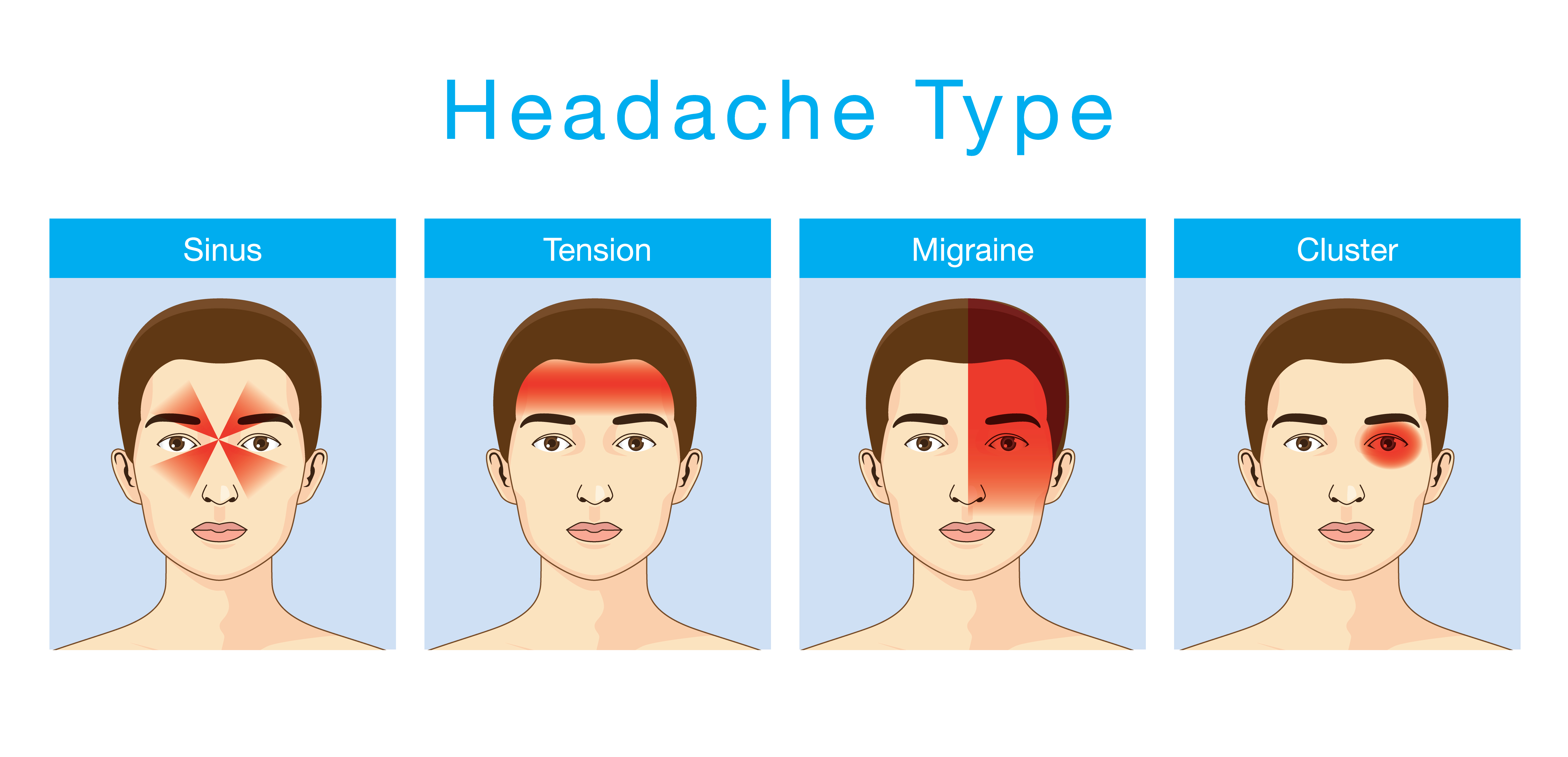 Головная боль переводчика. Виды головной боли. Types of headache. Мигрень. Головная боль иллюстрация.