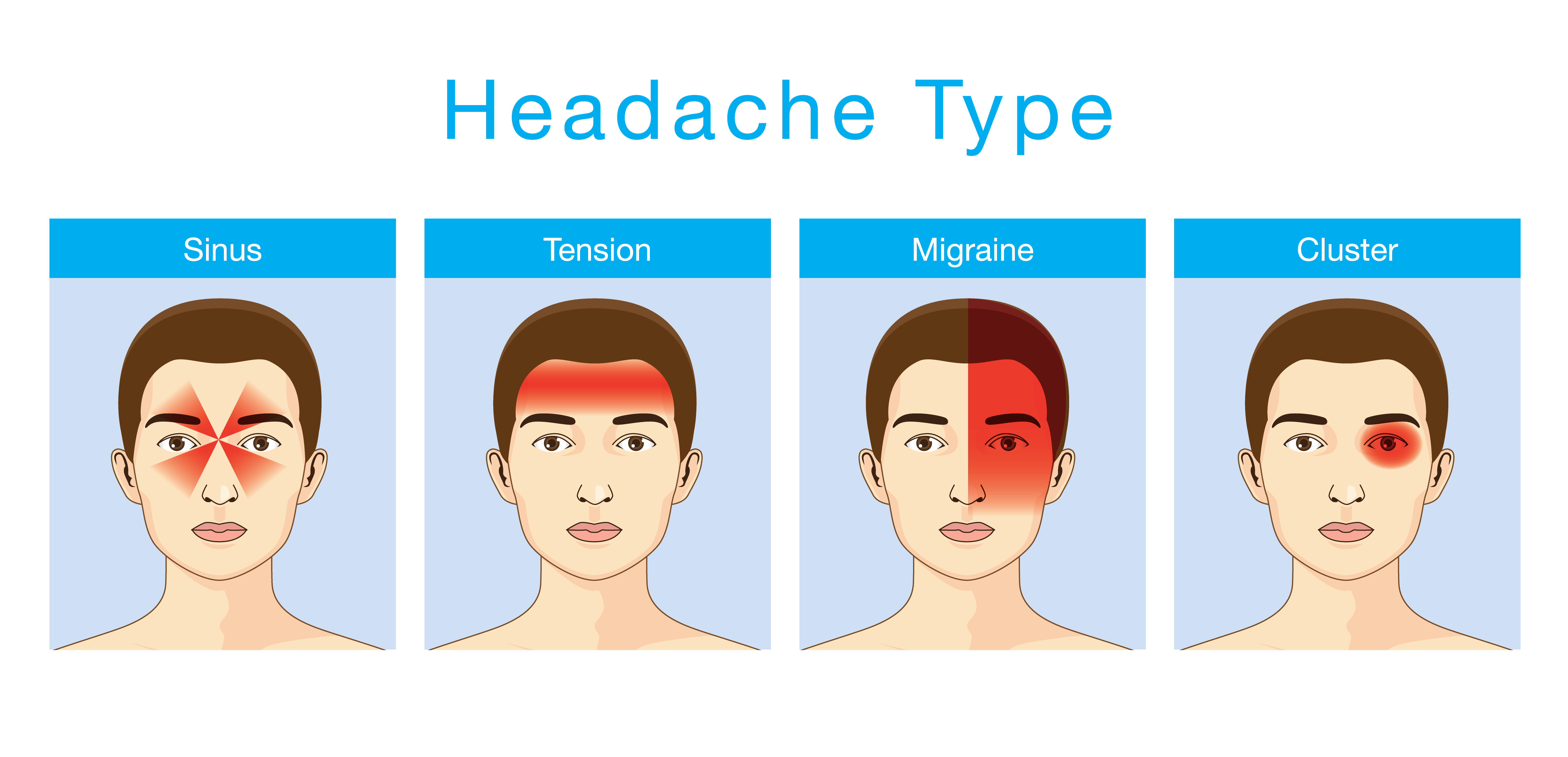 Sinus Headache Location Chart